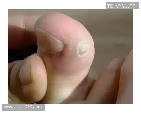 恩昆库脚趾疼痛基本消失或将入选对比萨比赛名单